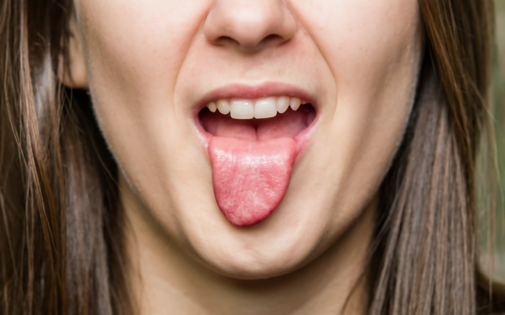 Tongue Problems causes and symptoms
