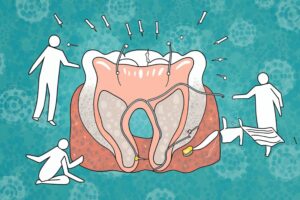 Symptoms of Periodontitis Dr.Goshop-The Remedy for Healthy Living What are the Causes and Symptoms of Periodontitis and how to Treat?