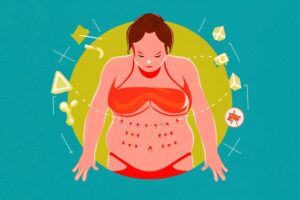 Ways to manage Adrenal Stress to Reduce Belly Fat Dr.Goshop-The Remedy for Healthy Living The Link between Adrenal Stress Fat and Stubborn Belly Fat!