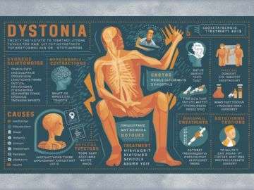 What are the Symptoms Causes and Treatments of Dystonia Dr.Goshop-The Remedy for Healthy Living What are the Symptoms, Causes and Treatments of Dystonia?