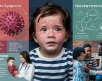 Causes, Symptoms and Treatment of Measles!