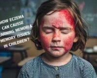 How Eczema can Cause Learning Memory Issues in Children qm6l1uonu7ipdzhkdtu3rrmtg1j0sl3nmeooum4j7k Dr.Goshop-The Remedy for Healthy Living Home