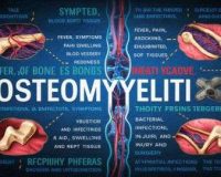 Signs Symptoms and Causes of Osteomyelitis Dr.Goshop-The Remedy for Healthy Living Home